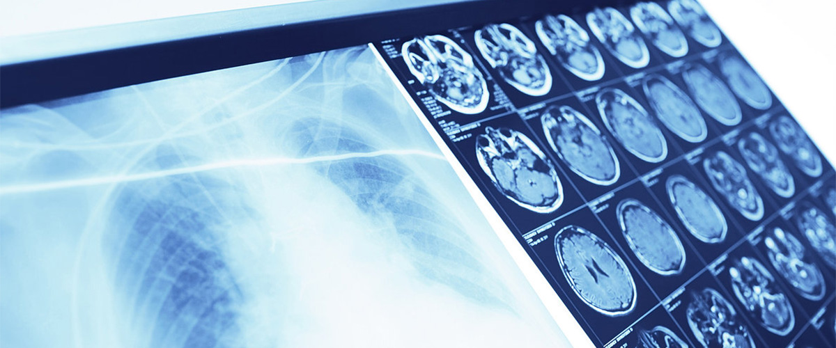 AI Healthcare: More Accurate Than Doctors?